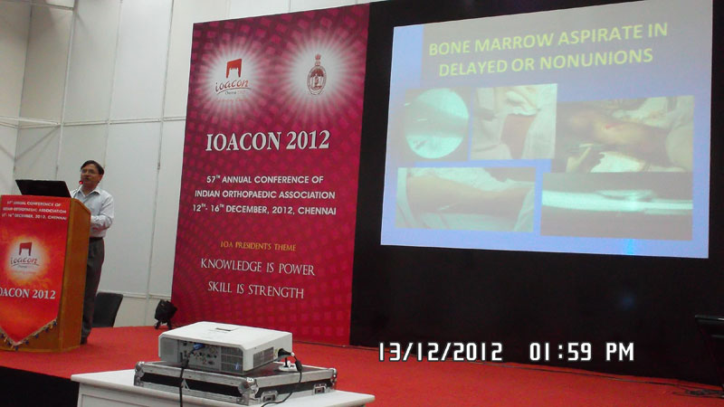 ioacon-chennai 1